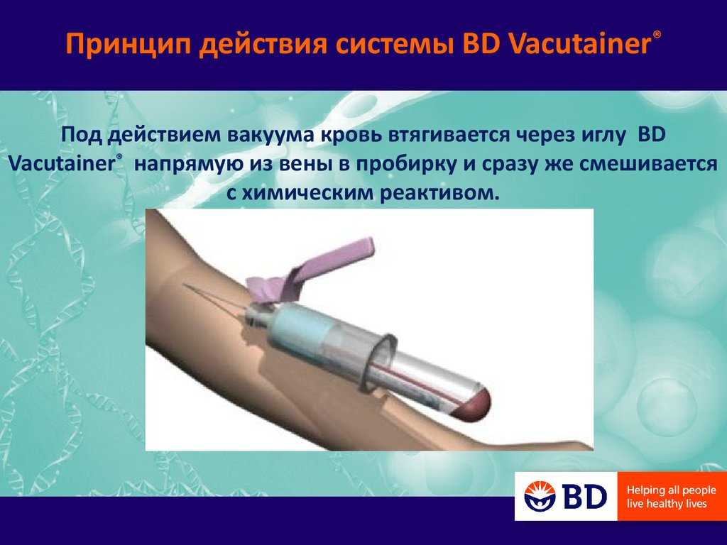 Вакутайнеры: вакуумные пробирки и иглы для забора крови, инструкци, vacuette, бектон дикинсон